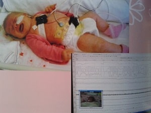 Polysomnografie voor Dummies
